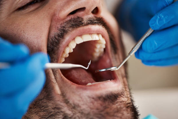 Best Walk-In Emergency Dentist in Bradfordville, FL